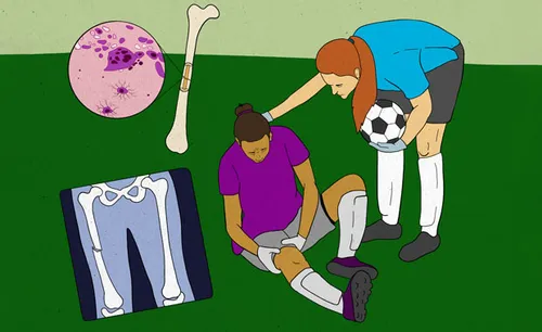 Illustration of an injured soccer player.